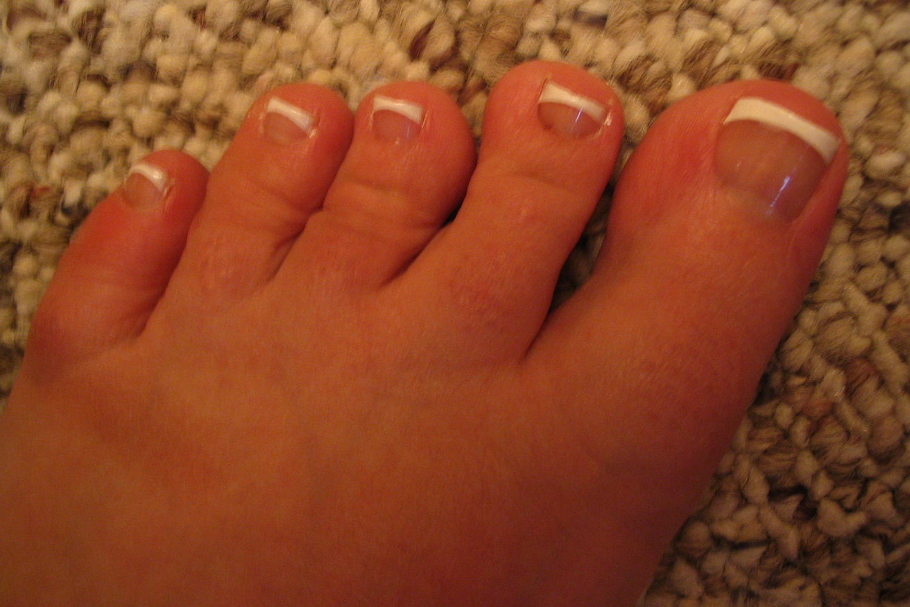 Toenails with a French pedicure finish of a pale base and white tips.