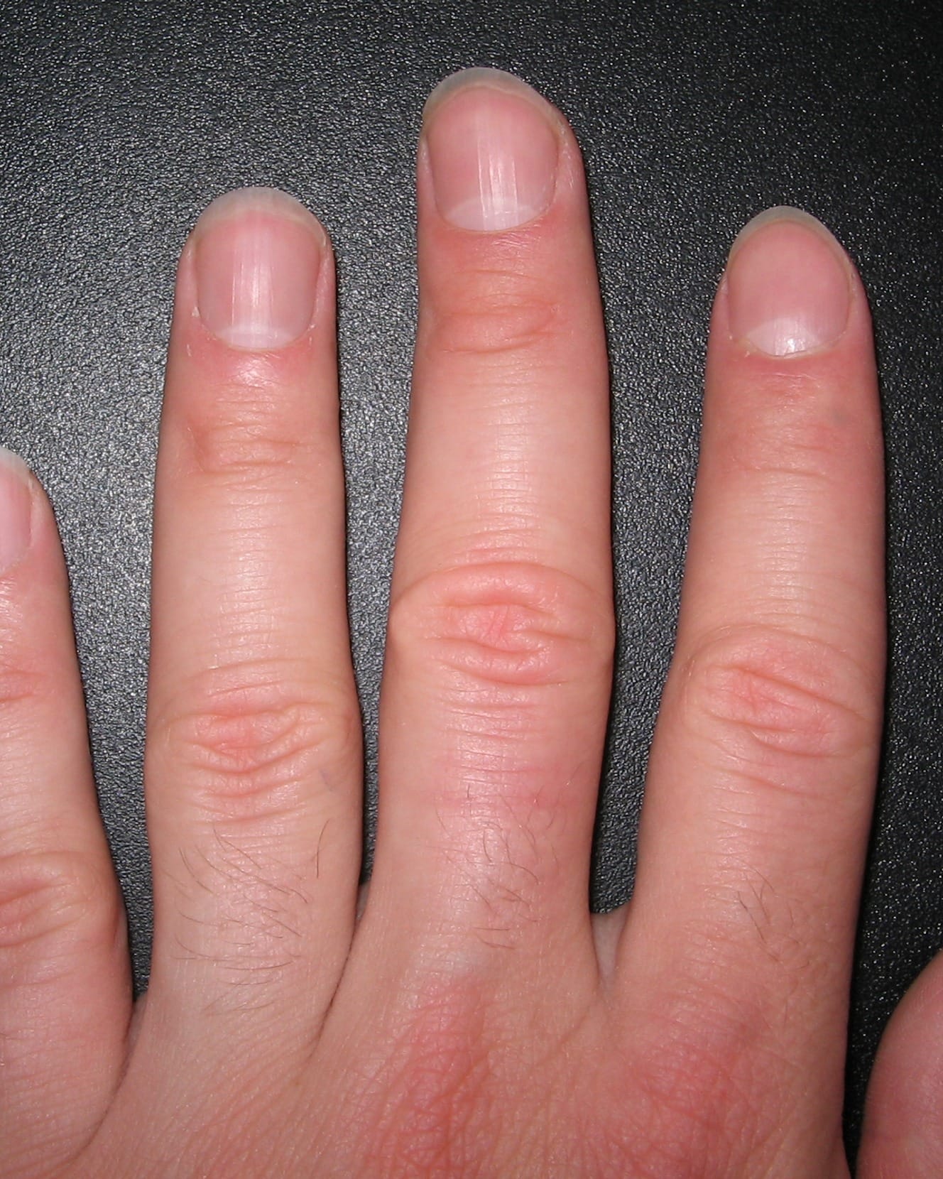 Four short, bare natural fingernails photographed close up.