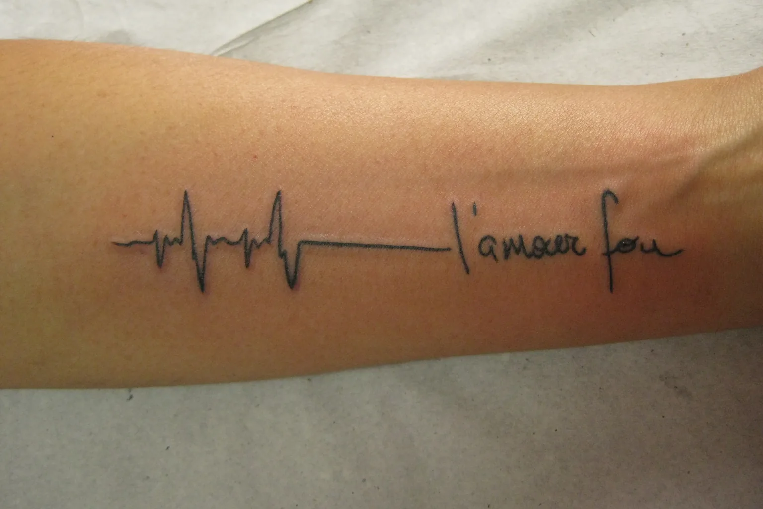 A healed fine-line forearm piece