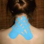 Kinesiology tape applied to a patient's neck