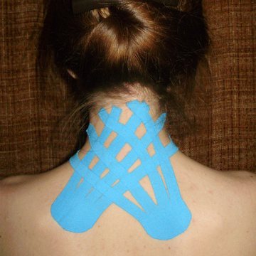 Blue kinesiology tape applied across the back of the neck and shoulders